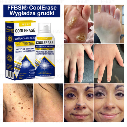 FFBSI® ❄ CoolErase Spray do regeneracji skóry  (Brodawe, Pęcherze, Wypryski, Łuszczyca, Zmiany skórne, Trądzik, Skórne narośle, Blizny, Pieprzyki)