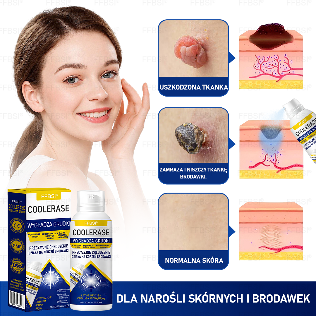 FFBSI® ❄ CoolErase Spray do regeneracji skóry  (Brodawe, Pęcherze, Wypryski, Łuszczyca, Zmiany skórne, Trądzik, Skórne narośle, Blizny, Pieprzyki)