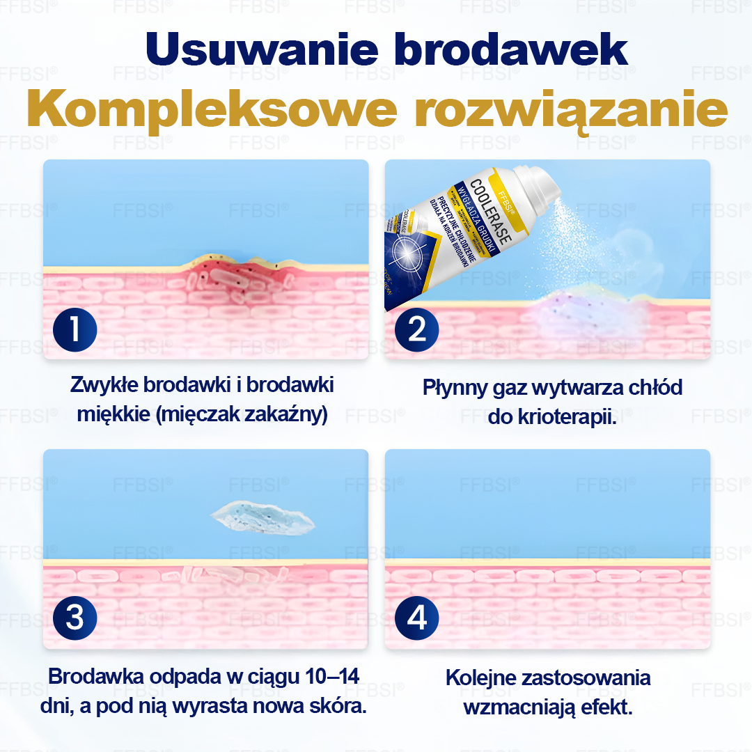 FFBSI® ❄ CoolErase Spray do regeneracji skóry  (Brodawe, Pęcherze, Wypryski, Łuszczyca, Zmiany skórne, Trądzik, Skórne narośle, Blizny, Pieprzyki)