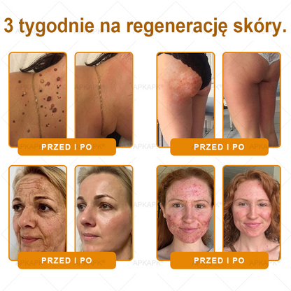 👧 𝖠𝖯𝖪𝖠𝖯𝖪® krem regenerujący skórę z jadem pszczelim