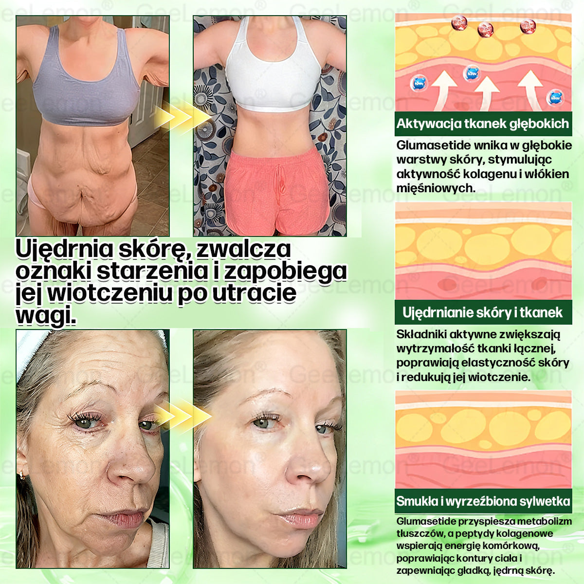 Oficjalny Sklep | 𝐆𝐞𝑒𝐿𝑒𝐦𝐨𝐧® 👩‍⚕️ 𝐆𝐥𝐮𝐦ase𝐭𝐢𝐝𝐞 𝟖 𝐰 𝟏 Smukły i Zdrowy Nano Plaster z Mikronakłuciami (Tylko raz dziennie, widoczne zmiany już w 7 dni)✅ Na otyłość, wiotką skórę, cukrzycę, bezdech senny, problemy ze stawami i wiele więcej