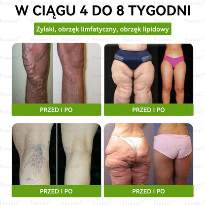 Oficjalny Sklep🥂Funutri® 10 w 1 metaboliczny wyszczuplający plaster z nanomikroigłami (Tylo raz dziennie – widoczne zmiany już w 7 dni) Wsparcie przy otyłości, cukrzycy, bezdechu sennym, problemach ze stawami i nie tylko