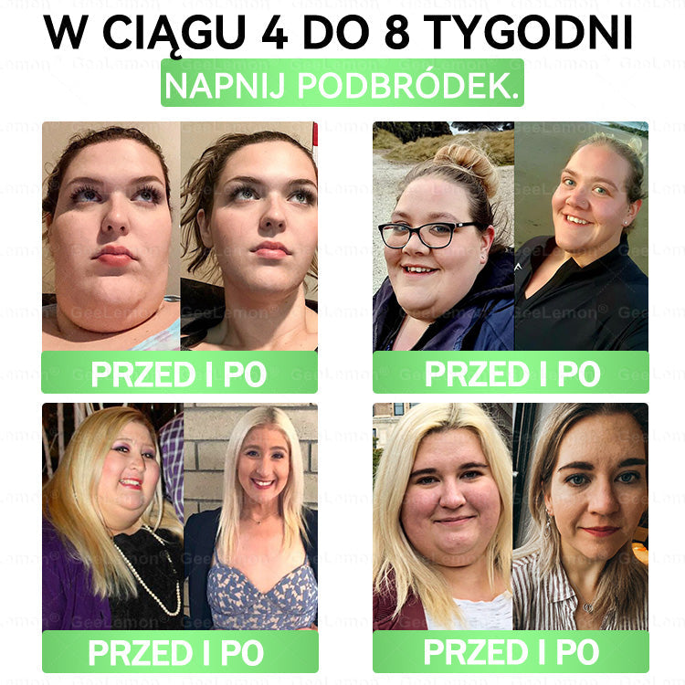 Oficjalny Sklep | 𝐆𝐞𝑒𝐿𝑒𝐦𝐨𝐧® 👩‍⚕️ 𝐆𝐥𝐮𝐦ase𝐭𝐢𝐝𝐞 𝟖 𝐰 𝟏 Smukły i Zdrowy Nano Plaster z Mikronakłuciami (Tylko raz dziennie, widoczne zmiany już w 7 dni)✅ Na otyłość, wiotką skórę, cukrzycę, bezdech senny, problemy ze stawami i wiele więcej