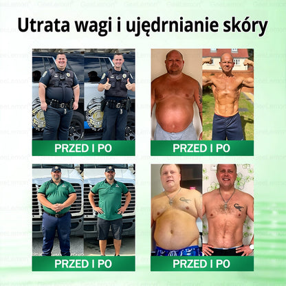 Oficjalny Sklep | 𝐆𝐞𝑒𝐿𝑒𝐦𝐨𝐧® 👩‍⚕️ 𝐆𝐥𝐮𝐦ase𝐭𝐢𝐝𝐞 𝟖 𝐰 𝟏 Smukły i Zdrowy Nano Plaster z Mikronakłuciami (Tylko raz dziennie, widoczne zmiany już w 7 dni)✅ Na otyłość, wiotką skórę, cukrzycę, bezdech senny, problemy ze stawami i wiele więcej