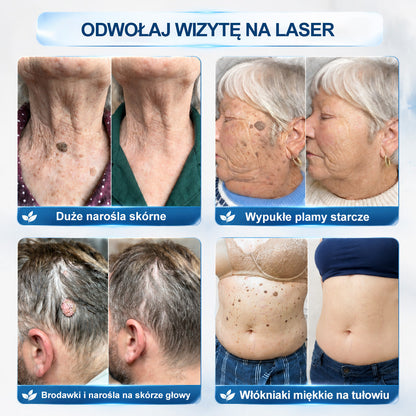 Oficjalny sklep markowy |🍀👑Hiskin® 7 𝑫𝒏𝒊 𝑷𝒓𝒆𝒑𝒂𝒓𝒂𝒕 𝑫𝒐 𝑼𝒔𝒖𝒘𝒂𝒏𝒊𝒂 𝑾łó𝒌𝒏𝒊𝒂𝒌ó𝒘 𝑴𝒊ę𝒌𝒌𝒊𝒄𝒉 𝑰 𝑷𝒓𝒛𝒆𝒃𝒂𝒓𝒘𝒊𝒆ń(𝐁𝐞𝐳 𝐁ó𝐥𝐮, 𝐁𝐞𝐳 𝐁𝐥𝐢𝐳𝐧 – 𝐑𝐨𝐥𝐥-𝐨𝐧)