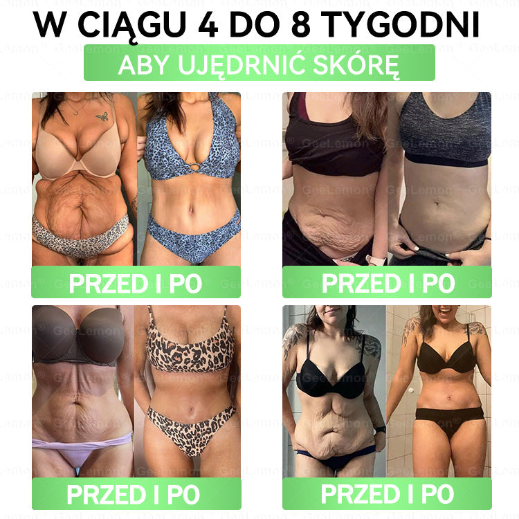 Oficjalny Sklep | 𝐆𝐞𝑒𝐿𝑒𝐦𝐨𝐧® 👩‍⚕️ 𝐆𝐥𝐮𝐦ase𝐭𝐢𝐝𝐞 𝟖 𝐰 𝟏 Smukły i Zdrowy Nano Plaster z Mikronakłuciami (Tylko raz dziennie, widoczne zmiany już w 7 dni)✅ Na otyłość, wiotką skórę, cukrzycę, bezdech senny, problemy ze stawami i wiele więcej