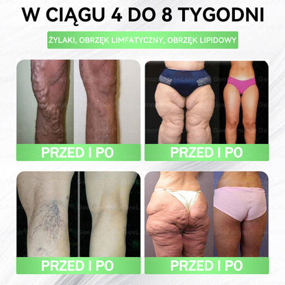 Oficjalny Sklep | 𝐆𝐞𝑒𝐿𝑒𝐦𝐨𝐧® 👩‍⚕️ 𝐆𝐥𝐮𝐦ase𝐭𝐢𝐝𝐞 𝟖 𝐰 𝟏 Smukły i Zdrowy Nano Plaster z Mikronakłuciami (Tylko raz dziennie, widoczne zmiany już w 7 dni)✅ Na otyłość, wiotką skórę, cukrzycę, bezdech senny, problemy ze stawami i wiele więcej