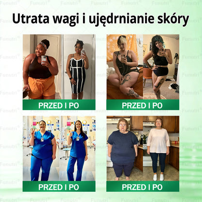 Oficjalny Sklep🥂Funutri® 10 w 1 metaboliczny wyszczuplający plaster z nanomikroigłami (Tylo raz dziennie – widoczne zmiany już w 7 dni) Wsparcie przy otyłości, cukrzycy, bezdechu sennym, problemach ze stawami i nie tylko