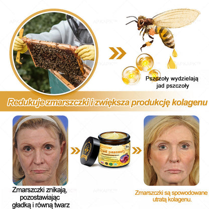 𝖠𝖯𝖪𝖠𝖯𝖪® 🐝𝗕𝗲𝗲 𝗩𝗲𝗻𝗼𝗺 𝗞𝗿𝗲𝗺 𝗻𝗮 𝗼𝗯𝗻𝗼𝘄𝗲𝗻𝗶𝗲 𝗸𝗼𝘇𝗵𝘆🐝pomaga w leczeniu problemów skórnych, takich jak: zmarszczki, blizny, plamy pigmentacyjne, rozstępy, trądzik, łuszczyca, egzema, zmiany skórne, podrażnienia, stany zapalne i inne problemy skórne