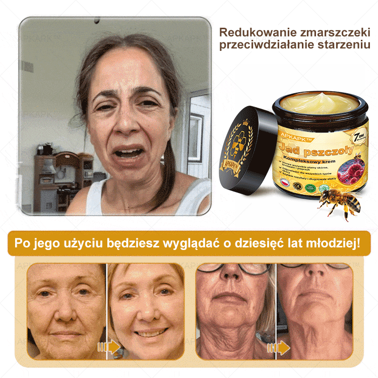 ⏰ Zostało tylko kilka sztuk na magazynie! Skorzystaj z wyjątkowej zniżki -30%⏰ΑPΚΑPK™