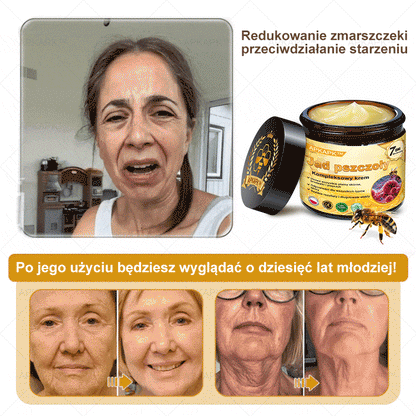 𝖠𝖯𝖪𝖠𝖯𝖪® 🐝𝗕𝗲𝗲 𝗩𝗲𝗻𝗼𝗺 𝗞𝗿𝗲𝗺 𝗻𝗮 𝗼𝗯𝗻𝗼𝘄𝗲𝗻𝗶𝗲 𝗸𝗼𝘇𝗵𝘆🐝pomaga w leczeniu problemów skórnych, takich jak: zmarszczki, blizny, plamy pigmentacyjne, rozstępy, trądzik, łuszczyca, egzema, zmiany skórne, podrażnienia, stany zapalne i inne problemy skórne