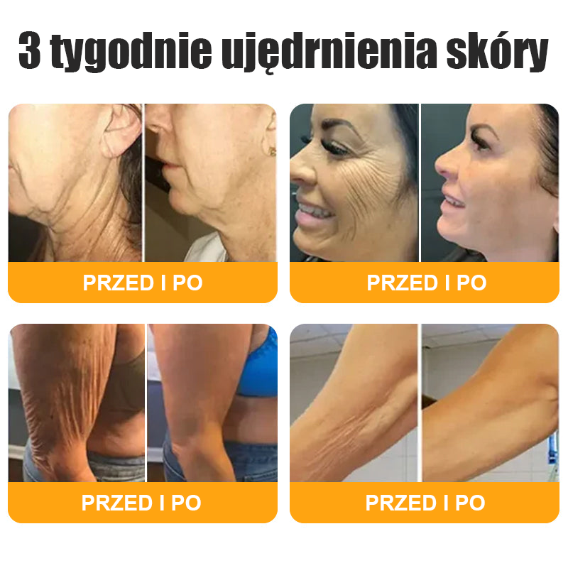 Ostatni dzień promocji: 50% zniżki - 🍯 HAJUEI® Botox Krem Przeciwzmarszczkowy z Jadłem Pszczelim