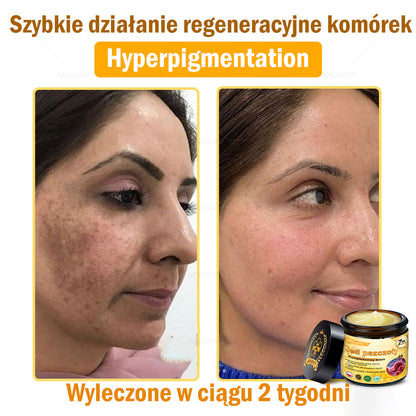 ⏰ Zostało tylko kilka sztuk na magazynie! Skorzystaj z wyjątkowej zniżki -30%⏰ΑPΚΑPK™