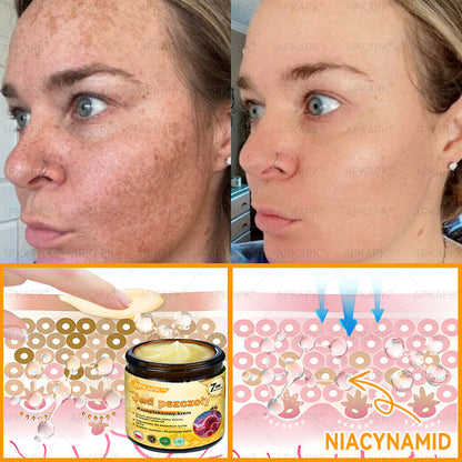 𝖠𝖯𝖪𝖠𝖯𝖪® 🐝𝗕𝗲𝗲 𝗩𝗲𝗻𝗼𝗺 𝗞𝗿𝗲𝗺 𝗻𝗮 𝗼𝗯𝗻𝗼𝘄𝗲𝗻𝗶𝗲 𝗸𝗼𝘇𝗵𝘆🐝pomaga w leczeniu problemów skórnych, takich jak: zmarszczki, blizny, plamy pigmentacyjne, rozstępy, trądzik, łuszczyca, egzema, zmiany skórne, podrażnienia, stany zapalne i inne problemy skórne
