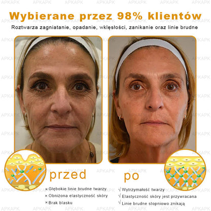 𝖠𝖯𝖪𝖠𝖯𝖪® 🐝𝗕𝗲𝗲 𝗩𝗲𝗻𝗼𝗺 𝗞𝗿𝗲𝗺 𝗻𝗮 𝗼𝗯𝗻𝗼𝘄𝗲𝗻𝗶𝗲 𝗸𝗼𝘇𝗵𝘆🐝pomaga w leczeniu problemów skórnych, takich jak: zmarszczki, blizny, plamy pigmentacyjne, rozstępy, trądzik, łuszczyca, egzema, zmiany skórne, podrażnienia, stany zapalne i inne problemy skórne