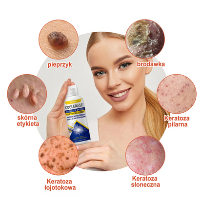 FFBSI® ❄ CoolErase Spray do regeneracji skóry  (Brodawe, Pęcherze, Wypryski, Łuszczyca, Zmiany skórne, Trądzik, Skórne narośle, Blizny, Pieprzyki)