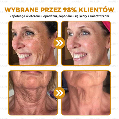 Ostatni dzień promocji: 50% zniżki - 🍯 HAJUEI® Botox Krem Przeciwzmarszczkowy z Jadłem Pszczelim
