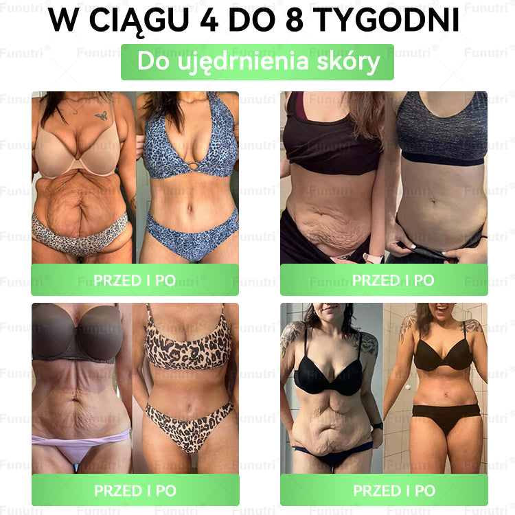 Oficjalny Sklep🥂Funutri® 10 w 1 metaboliczny wyszczuplający plaster z nanomikroigłami (Tylo raz dziennie – widoczne zmiany już w 7 dni) Wsparcie przy otyłości, cukrzycy, bezdechu sennym, problemach ze stawami i nie tylko
