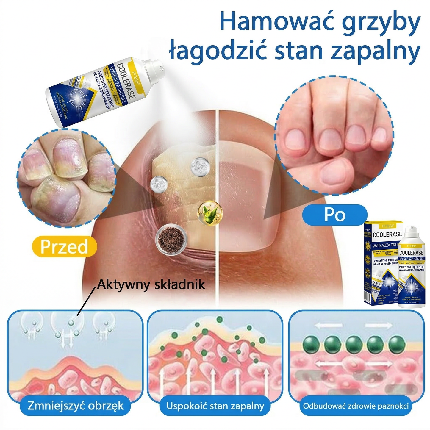 FFBSI® 🍀 CoolErase Spray do regeneracji skóry  (Brodawe, Pęcherze, Wypryski, Łuszczyca, Zmiany skórne, Trądzik, Skórne narośle, Blizny, Pieprzyki)