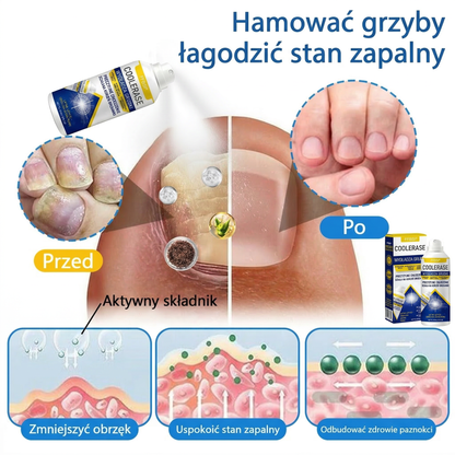 FFBSI® 🍀 CoolErase Spray do regeneracji skóry  (Brodawe, Pęcherze, Wypryski, Łuszczyca, Zmiany skórne, Trądzik, Skórne narośle, Blizny, Pieprzyki)