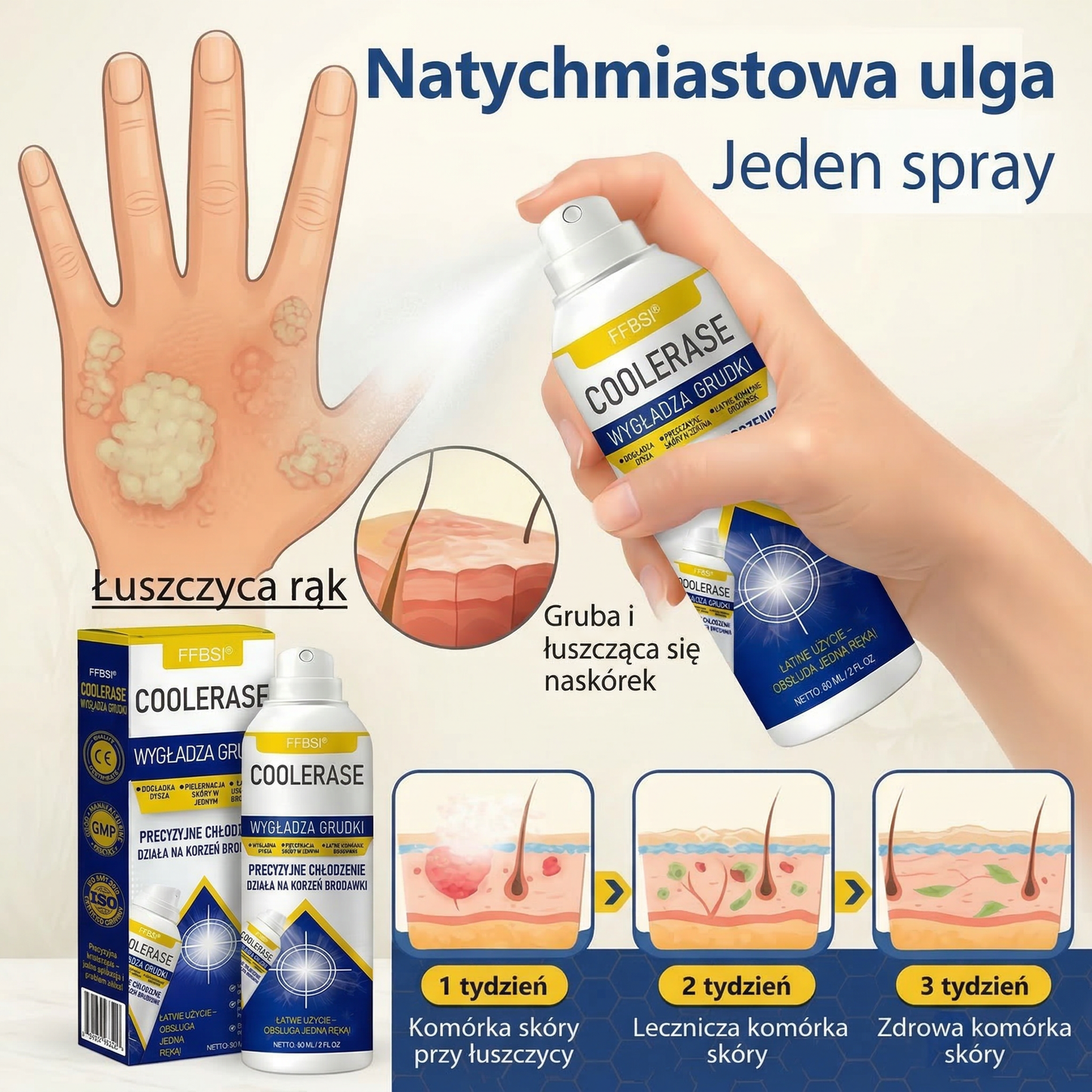 FFBSI® 🍀 CoolErase Spray do regeneracji skóry  (Brodawe, Pęcherze, Wypryski, Łuszczyca, Zmiany skórne, Trądzik, Skórne narośle, Blizny, Pieprzyki)